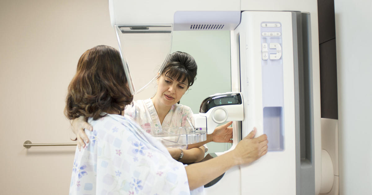 what-to-know-about-new-breast-cancer-screening-guidelines