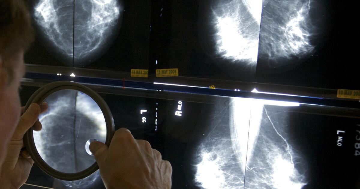 mammograms-should-start-at-40,-panel-says