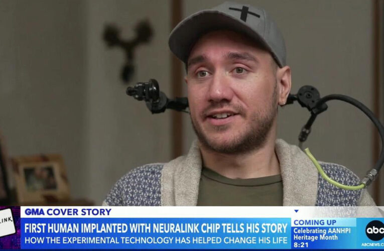 Neuralink’s first brain implant patient feared device would have to be removed
