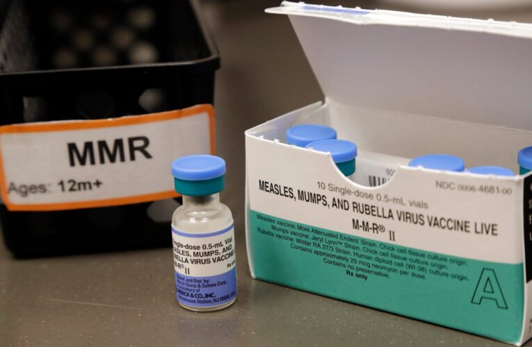 Public exposed to measles in Santa Clara and Santa Cruz counties