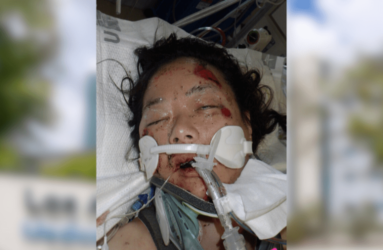 L.A. hospital seeks help identifying injured woman found on street