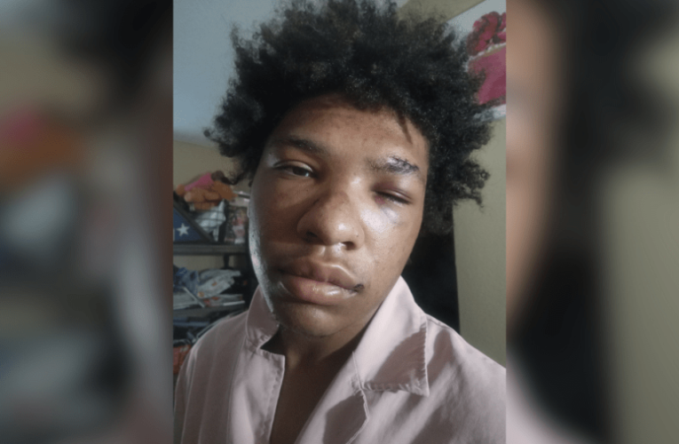 Mother of Southern California teen says her son was beaten by another student and his father 