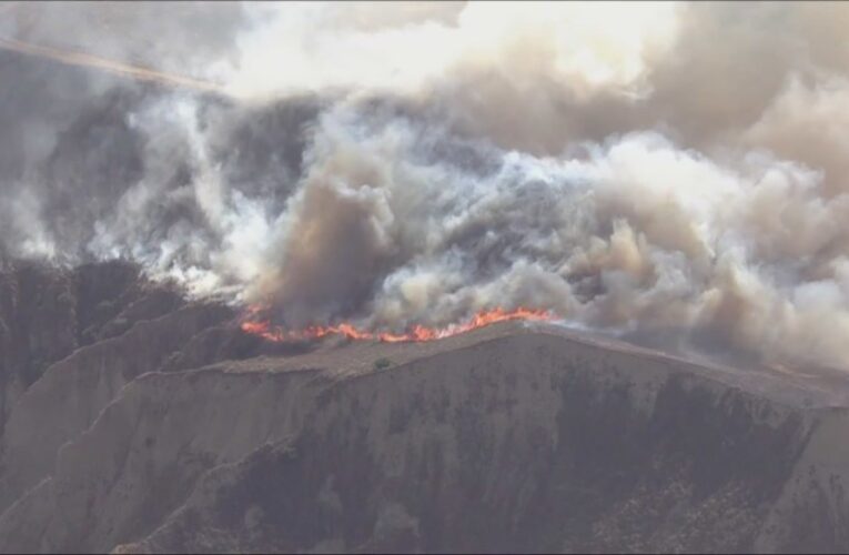 At least 1 home destroyed, people burned by fire in Ventura County