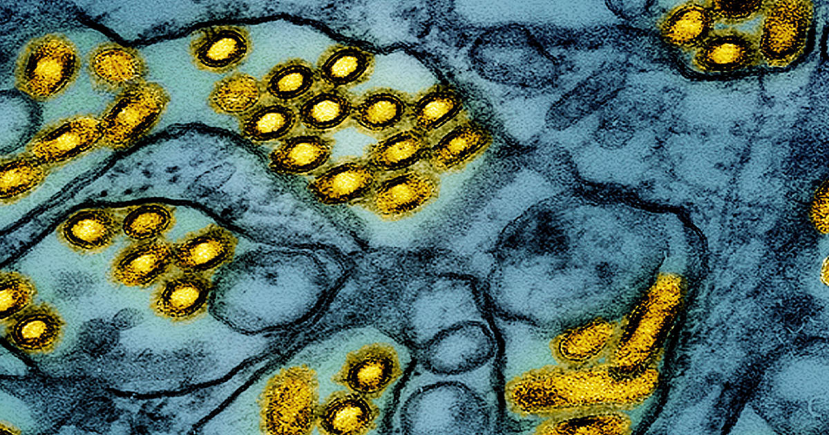 what-to-know-about-bird-flu-amid-dozens-of-human-cases-in-us.