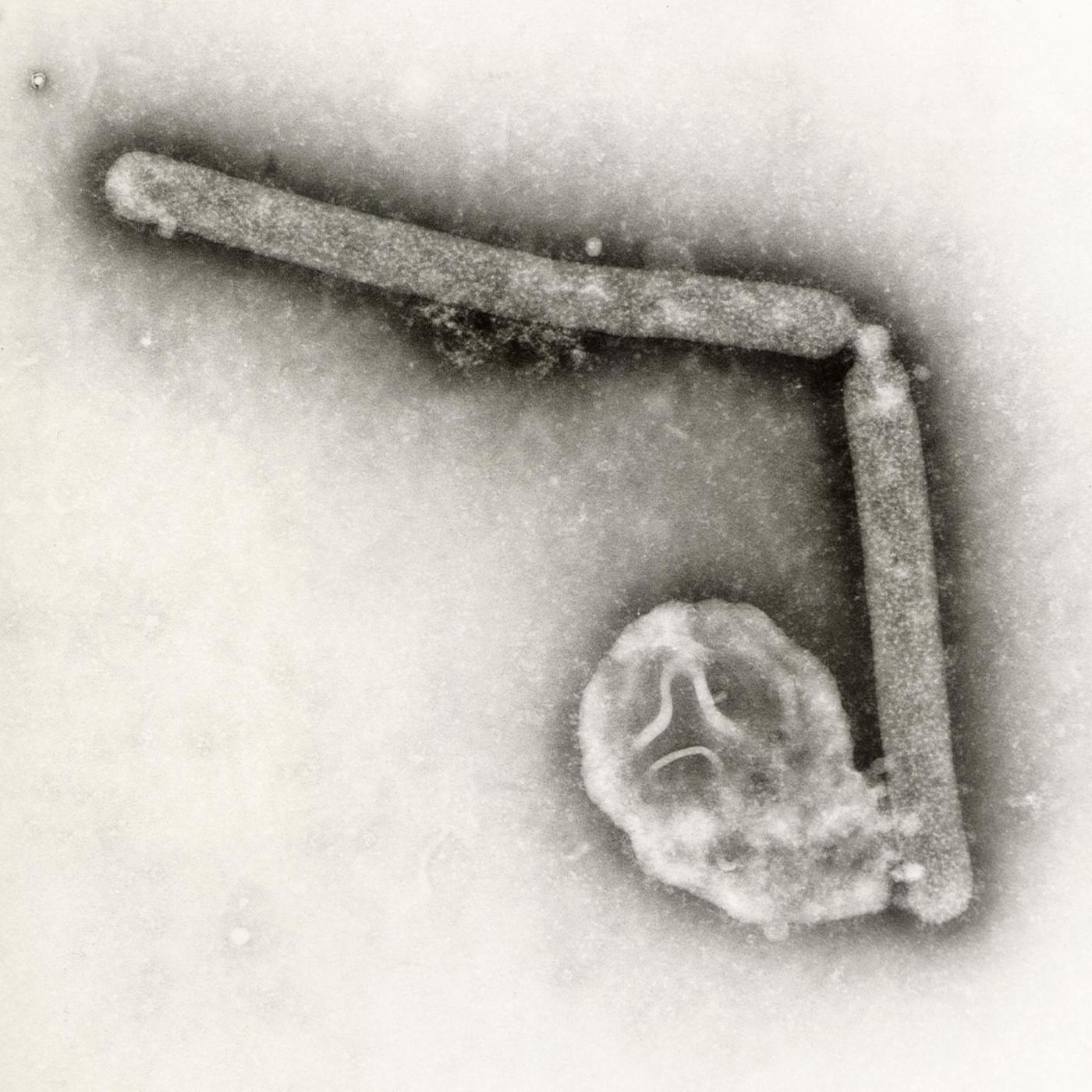 bird-flu-virus-likely-mutated-within-a-louisiana-patient,-cdc-says