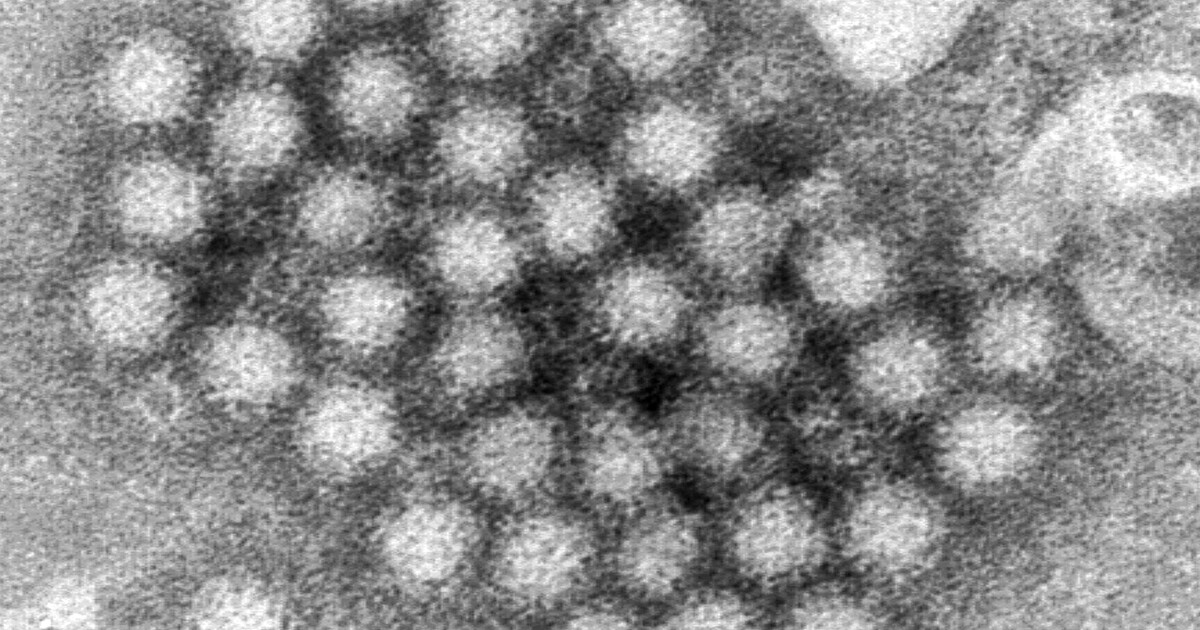 norovirus-cases-on-the-rise-locally-this-winter